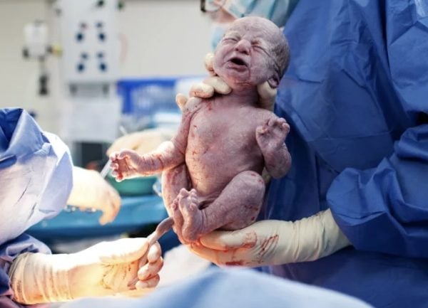 Caesarean Workshop - Beyond Birth Education