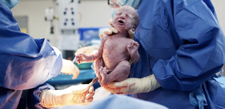 Caesarean Workshop - Beyond Birth Education